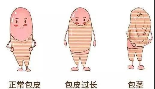 【保山安利醫(yī)院】家長速看！暑期包皮手術預約正當時！